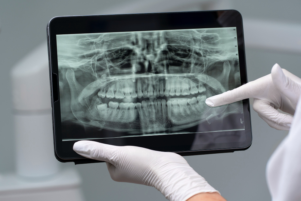 Digital X-Rays  Palo Alto, CA