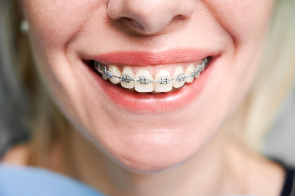 orthodontic services Palo Alto, CA
